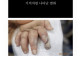 미국에서도 깜놀한 K-화상치료