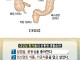 대장암 환자들의 공통된 생활습관