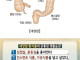 대장암 환자들의 공통된 습관