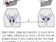 ?)약혐)여장기술,고추와 부랄 숨기기-탁(tuck)