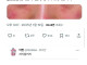 뷔페에서 알러지 생길만한 음식.jpg