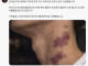 키스의 위험성