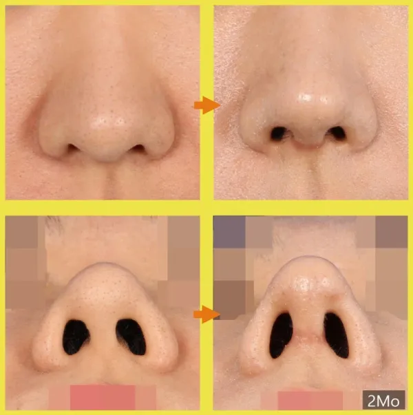 2059229089 dfa39db7 600x603